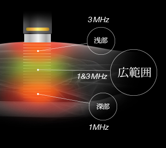 酒井医療器　フィジオソノ